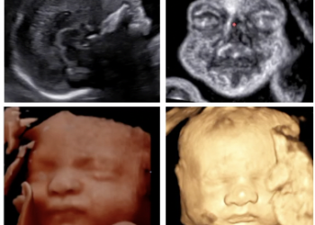 How To Do Agosto 2023: utilizzo del 3D nello studio del volto fetale