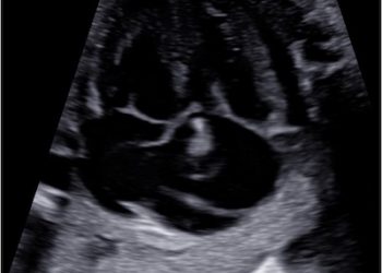 Casi del Mese di Agosto 2023