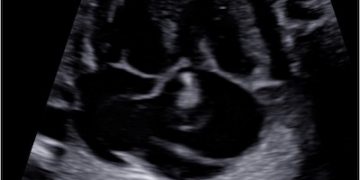 Casi del Mese di Agosto 2023