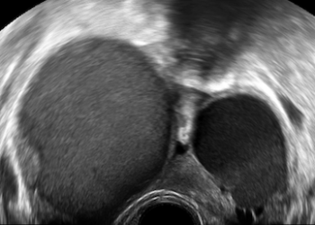 How To Do Settembre 2023: studio ecografico dell’endometriosi.