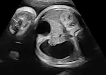 Casi del Mese di Settembre 2023