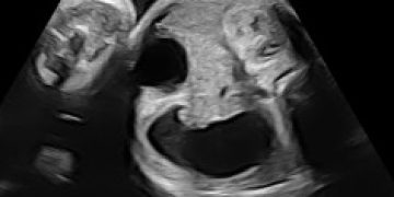 Casi del Mese di Settembre 2023