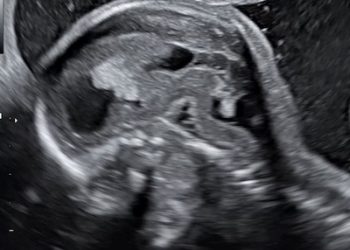 Casi del Mese di Ottobre 2023