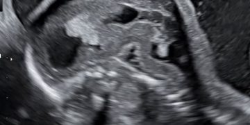 Casi del Mese di Ottobre 2023