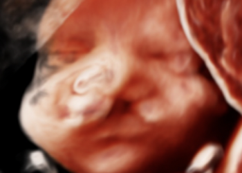 Guida al Counselling di Novembre 2023: labiopalatoschisi