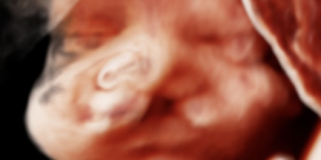 Guida al Counselling di Novembre 2023: labiopalatoschisi