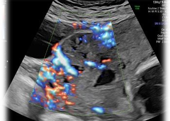 Casi del Mese di Novembre 2023