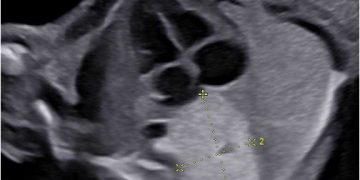 Casi del Mese di Dicembre 2023