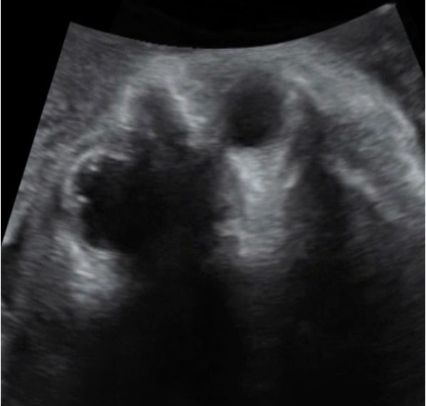 How To Do Dicembre 2023: ecografia in sala parto