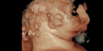 Casi del Mese di Gennaio 2024