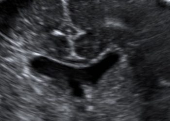 Casi del Mese di Febbraio 2024