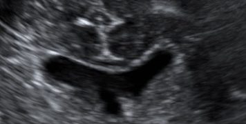 Casi del Mese di Febbraio 2024