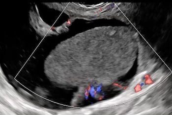 Casi del Mese di Marzo 2024