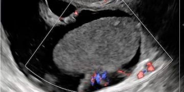 Casi del Mese di Marzo 2024