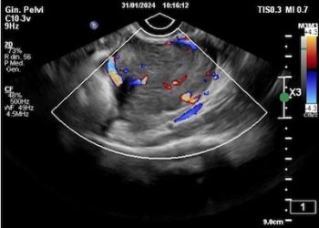 Casi del Mese di Maggio 2024