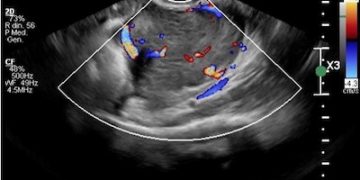Casi del Mese di Maggio 2024