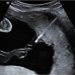 How To Do Giugno 2024: diagnosi e gestione delle anemie fetali