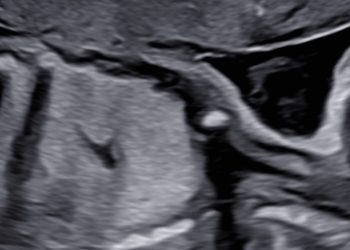 Casi del Mese di Giugno 2024