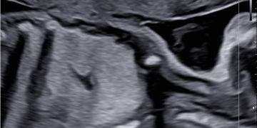 Casi del Mese di Giugno 2024