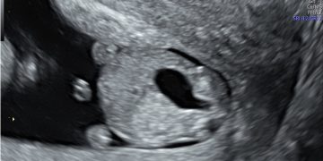 Casi del Mese di Luglio 2024