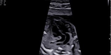 Casi del Mese di Agosto 2024