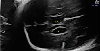 Casi del Mese di Settembre 2024