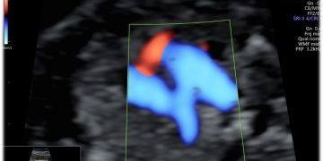 Casi del Mese di Ottobre 2024