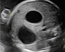 Casi del Mese di Novembre 2024