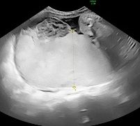 Casi del Mese di Dicembre 2024