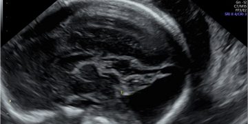 Casi del Mese di Gennaio 2025