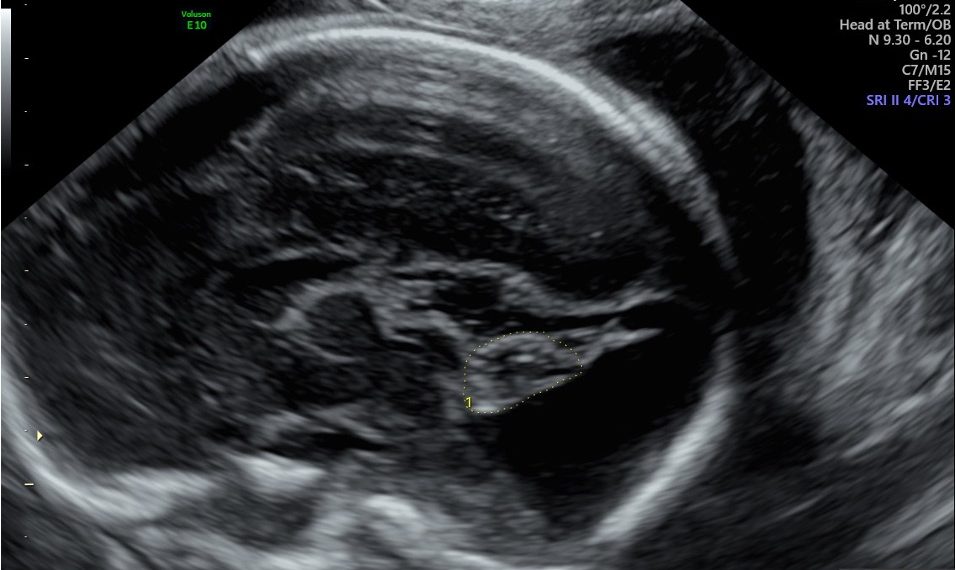 Casi del Mese di Gennaio 2025