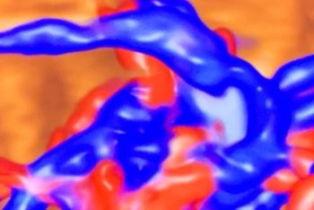 Guida al Counselling di Febbraio 2025: coartazione aortica