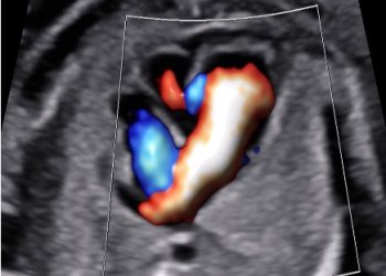 Casi del Mese di Marzo 2025