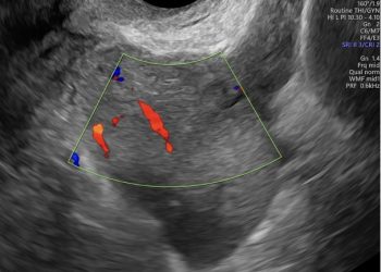 Casi del Mese di Giugno 2025