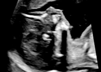 Casi del Mese di Luglio 2025