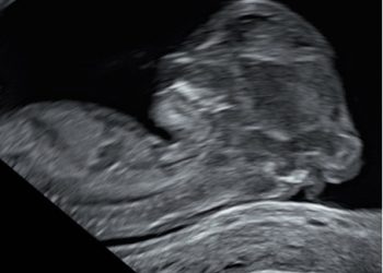 Casi del Mese di Agosto  2025