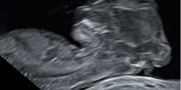 Casi del Mese di Agosto  2025