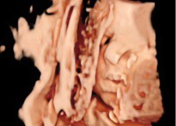 Casi del Mese di Settembre  2025