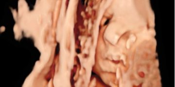 Casi del Mese di Settembre  2025