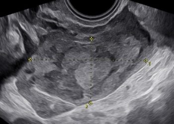 Casi del Mese di Ottobre  2025