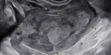 Casi del Mese di Ottobre  2025