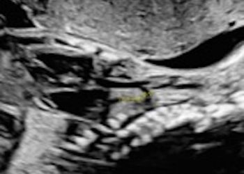 Casi del Mese di Novembre  2025