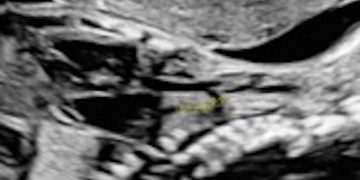 Casi del Mese di Novembre  2025