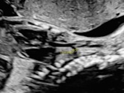 Casi del Mese di Novembre 2025