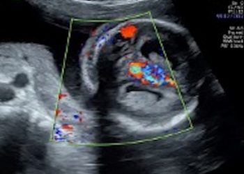 Casi del Mese di Dicembre 2025