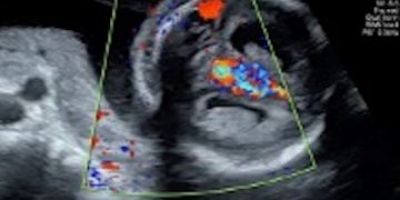 Casi del Mese di Dicembre 2025