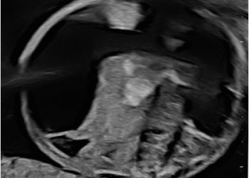 Casi del Mese di Gennaio 2026