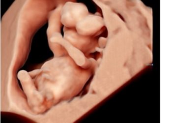 Casi del Mese di Febbraio 2026