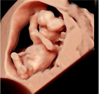 Casi del Mese di Febbraio 2026