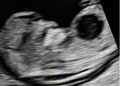 Casi del Mese di Marzo 2026